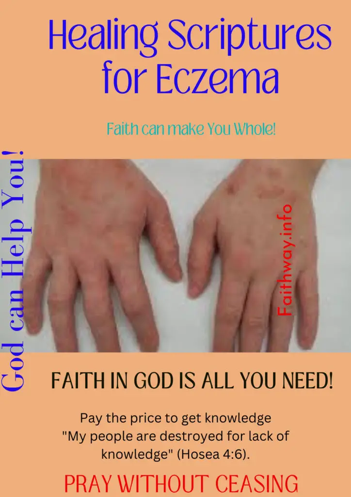 21 Escrituras curativas para el eczema: Versículos bíblicos KJV -