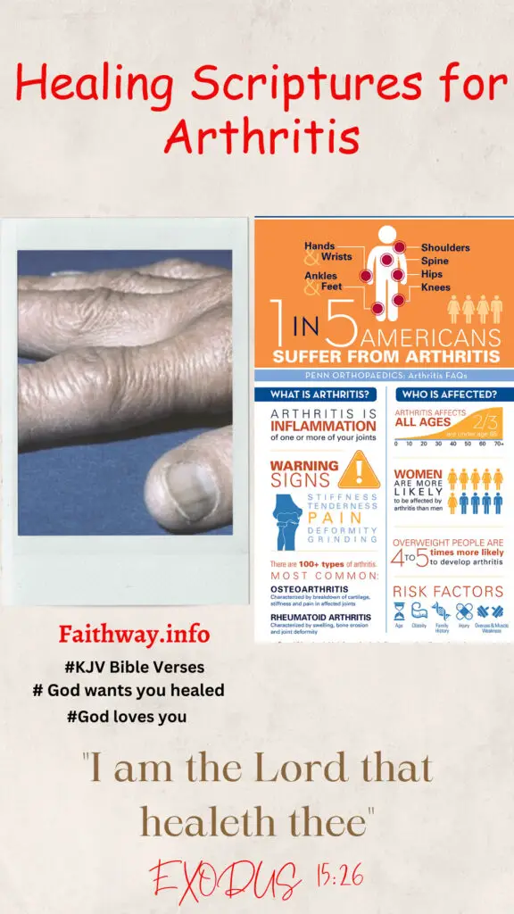 “Debe leer” 22 Escrituras curativas para la artritis: Versículos bíblicos KJV -