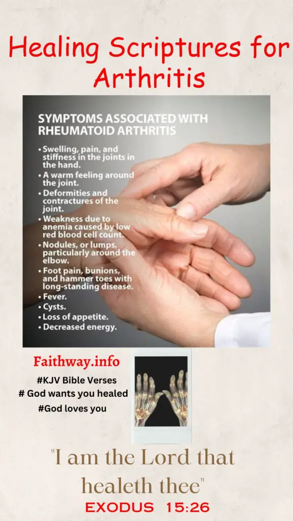 “Debe leer” 22 Escrituras curativas para la artritis: Versículos bíblicos KJV -